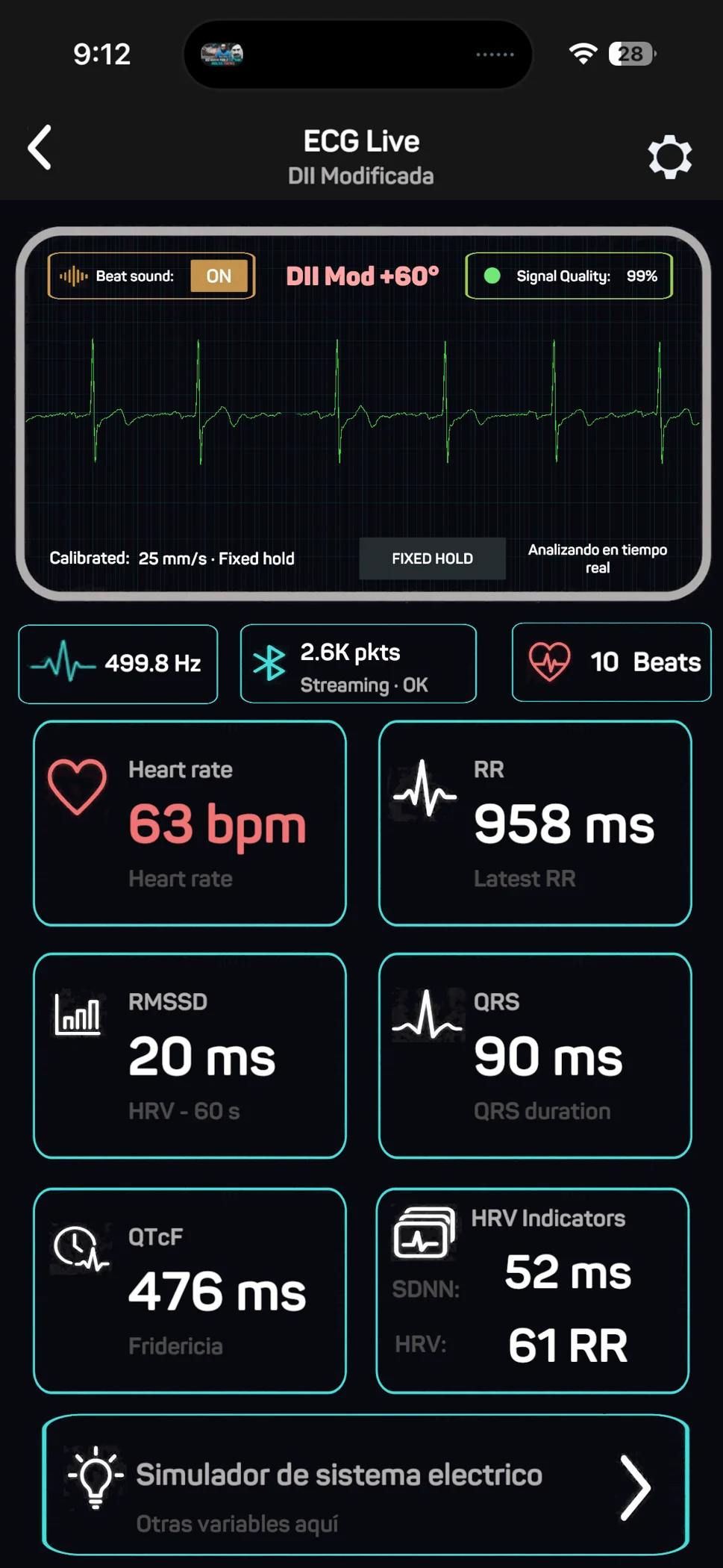 Captura real de la señal y variables de la interfaz ECG Live de GuiAR